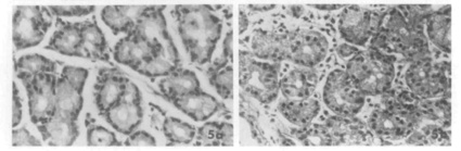 0male female tear gland differences WEB.jpg