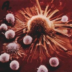 Cancer cell1.jpg
