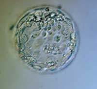 stem_cells.jpg